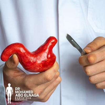 The variety of bariatric surgeries