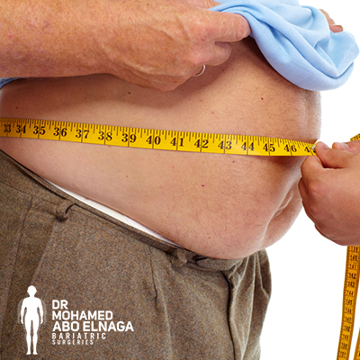Bariatric Surgeries are for your benefits