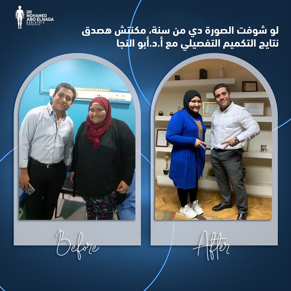 مخاطر-التكميم