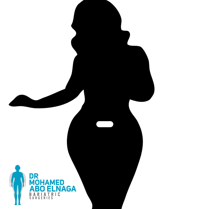 Bikini Line Gastric Sleeve