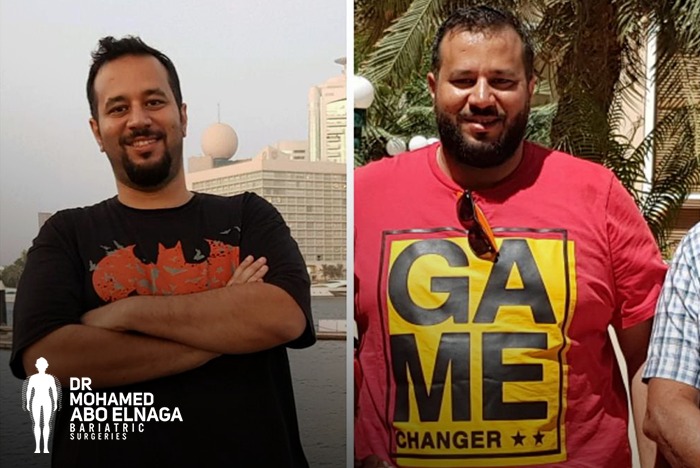 جراحات السمنة