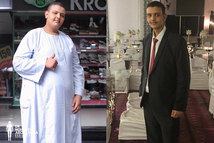 أستشارى أمراص السمنة