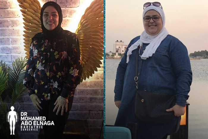أستشارى أمراص السمنة - جراحة السمنة